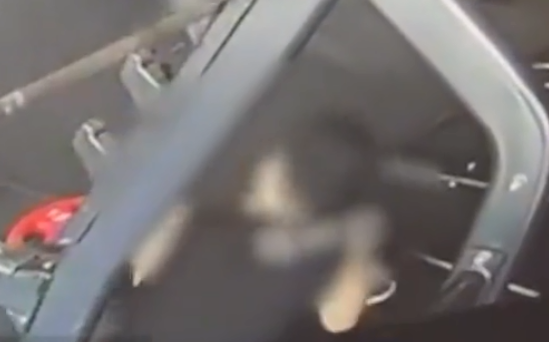 小伙健身时铁饼突然脱落旁边男子被砸伤一脸痛苦检查后被诊断脚骨折(图1)