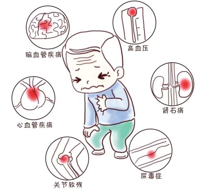 高尿酸=痛风？降尿酸饮食运动攻略来啦！(图2)