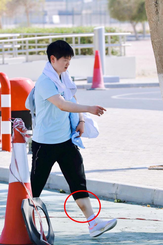 威廉希尔国乒抵达多哈首次训练孙颖莎被发现小腿大面积淤青令人心疼！(图3)
